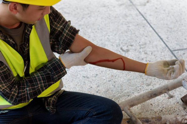 Injury bleeding from work accident in pile of scaffolding steel falling down to impinge the arm of young builder
