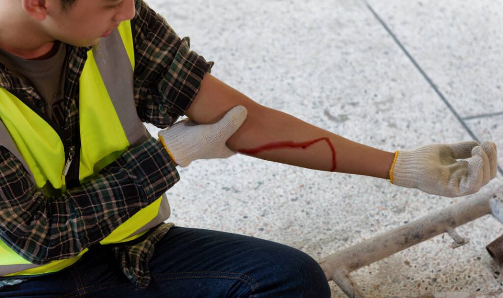 Injury bleeding from work accident in pile of scaffolding steel falling down to impinge the arm of young builder